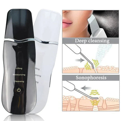 4 in 1 Ultrasonic Skin Spatula