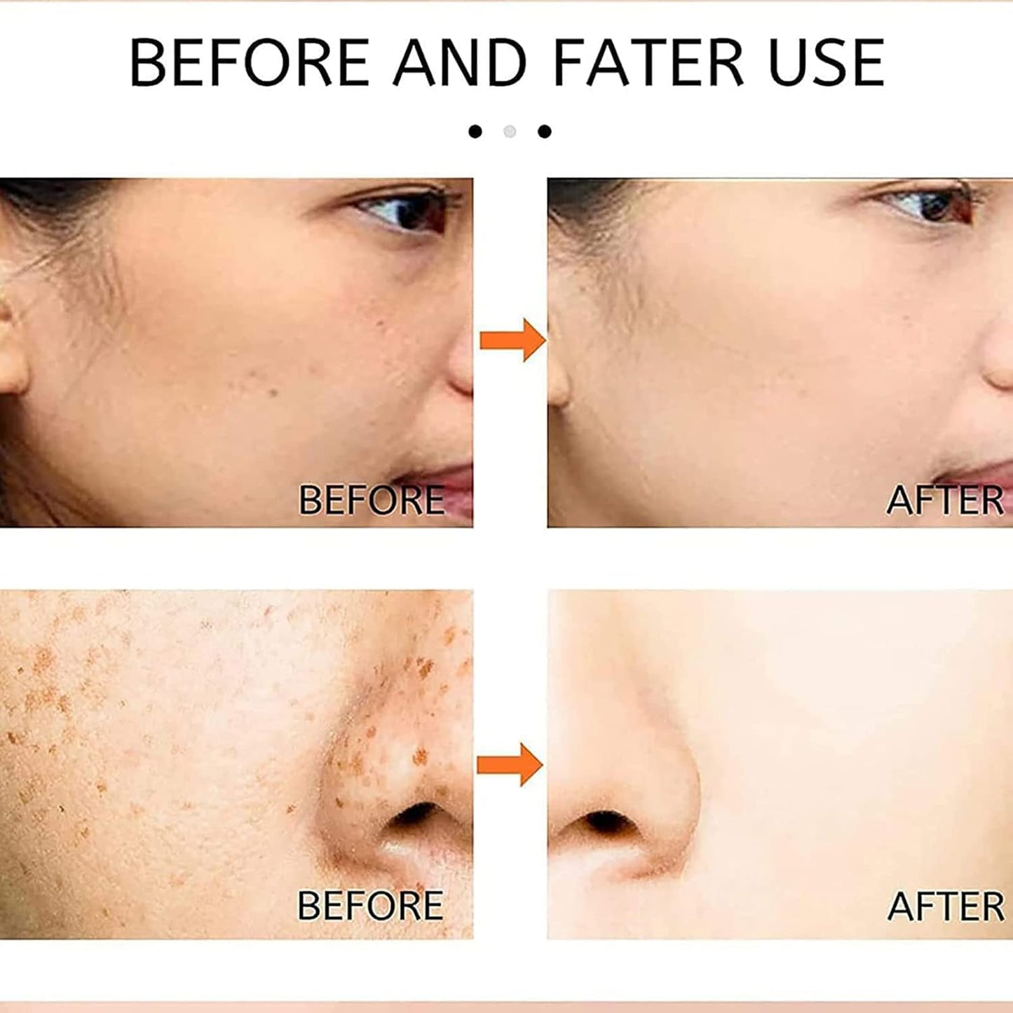 Gionar Japanese Melasma Cream