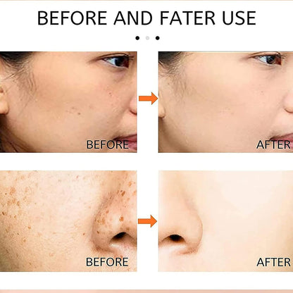 Gionar Japanese Melasma Cream