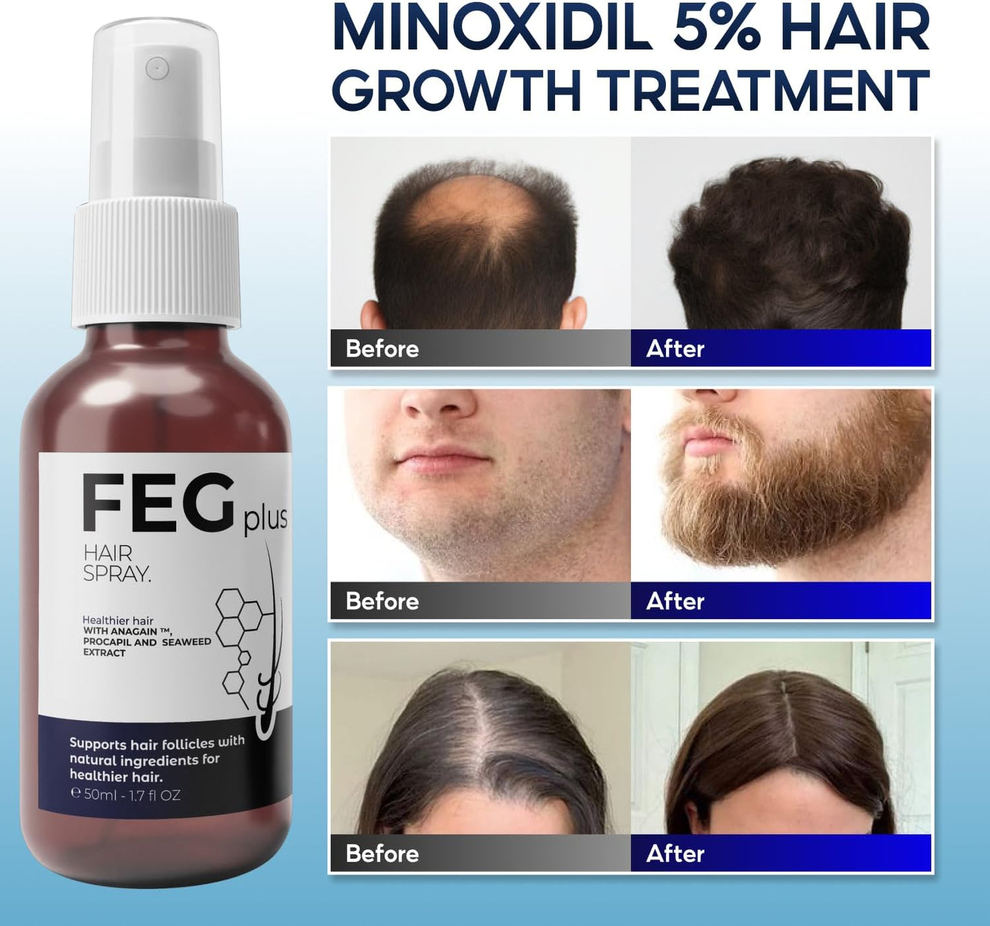 FEG Plus Hair Growth Serum (50ml)