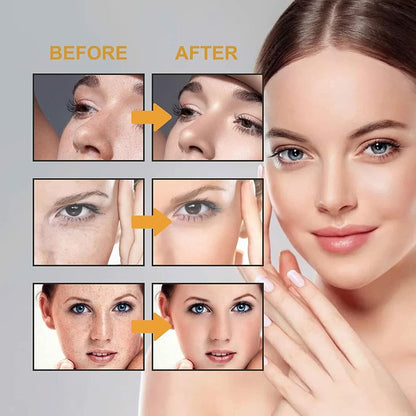 Gionar Japanese Melasma Cream