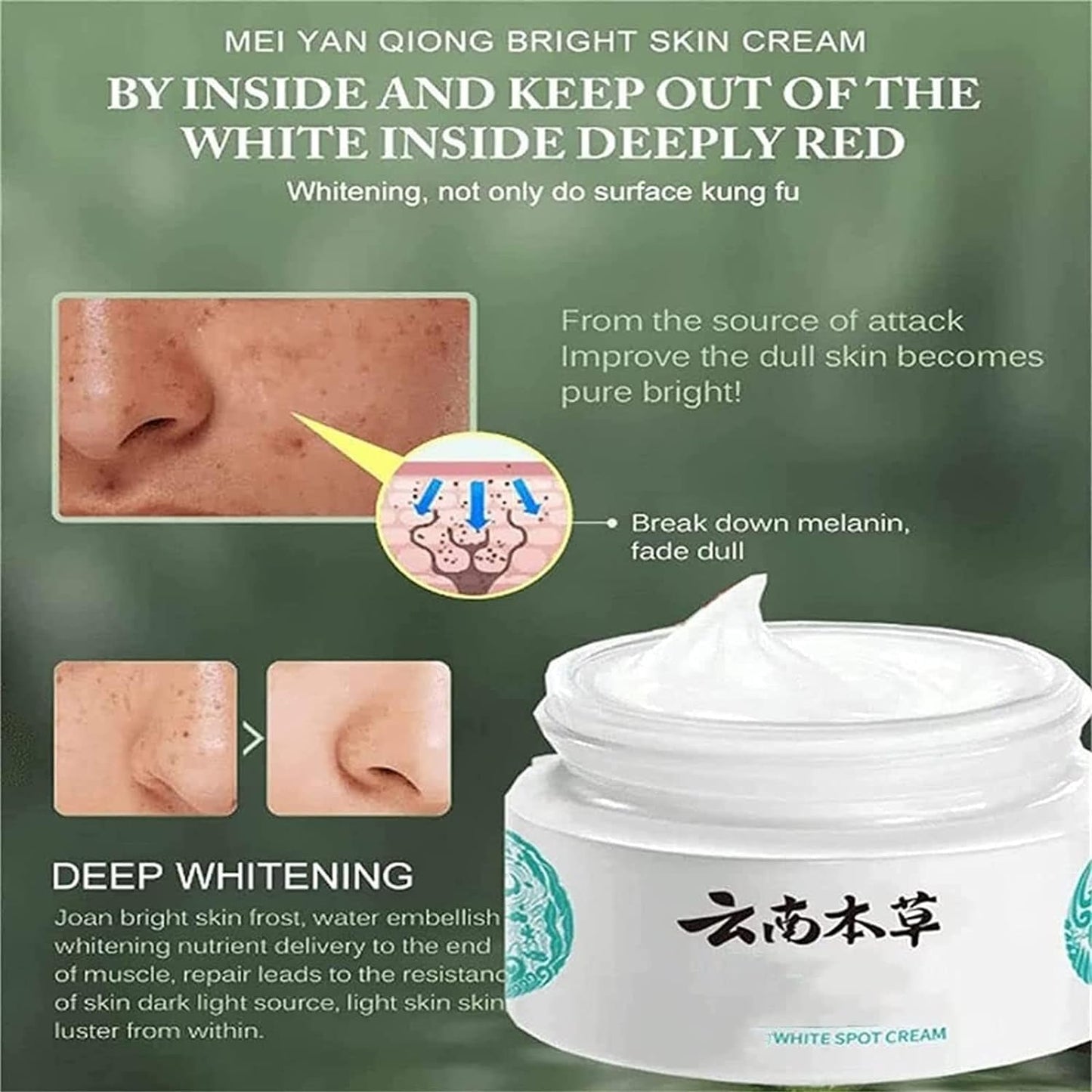 Gionar Japanese Melasma Cream