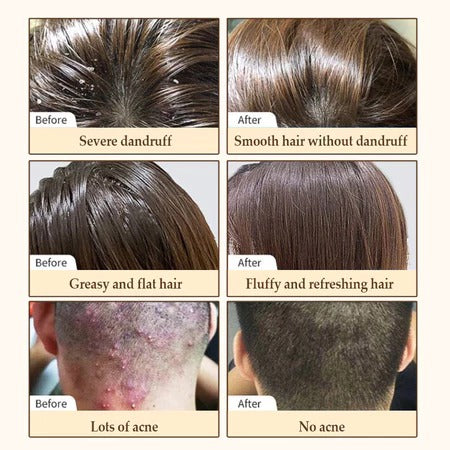 Biotin Hair Growth Shampoo 250ml