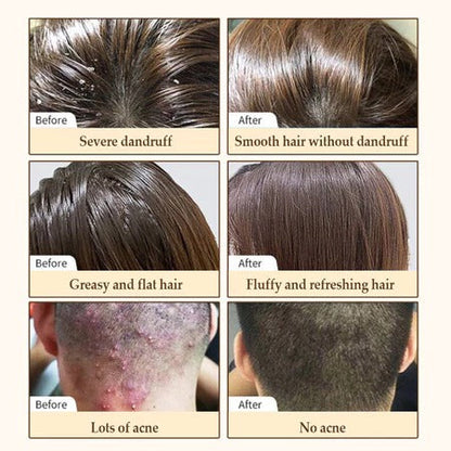 Biotin Hair Growth Shampoo 250ml