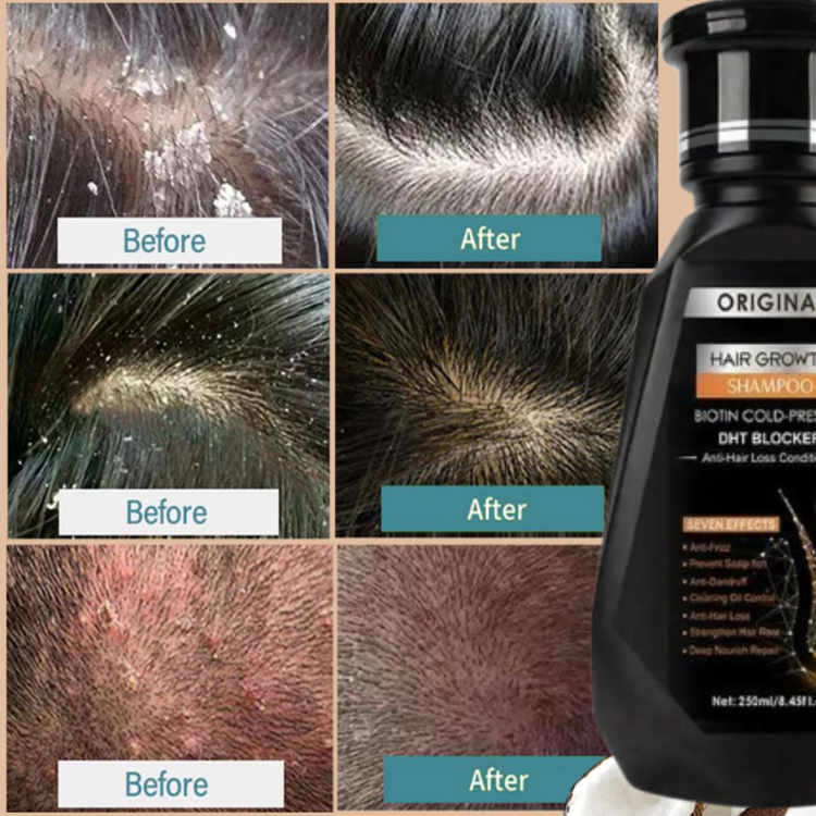 Biotin Hair Growth Shampoo 250ml