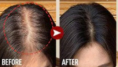 Biotin Hair Growth Shampoo 250ml